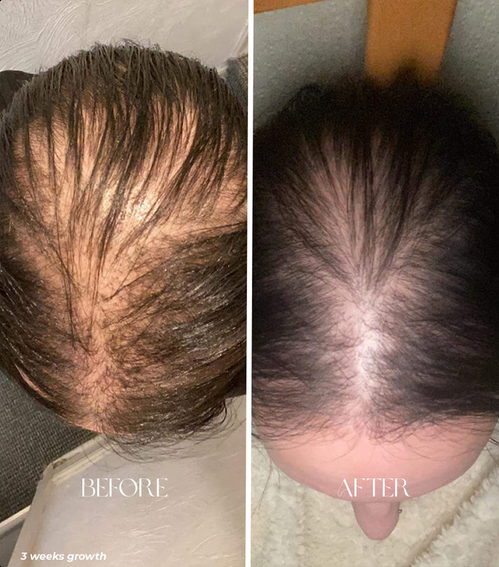 BowLift | Hair oil applicator bottle