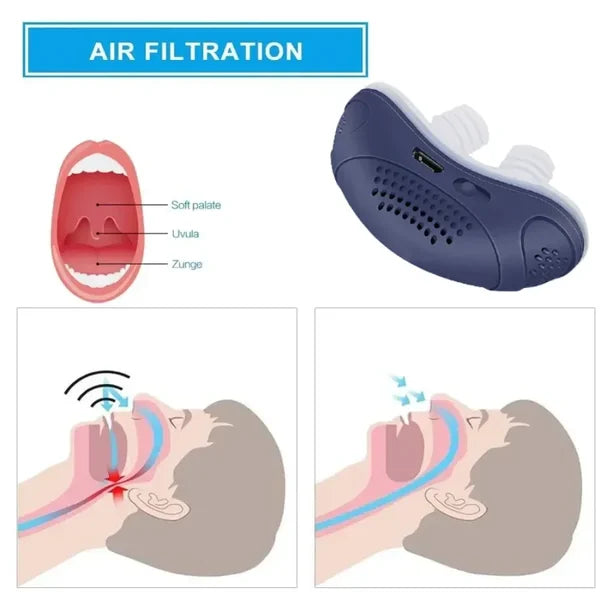 BowLift | Sleepless, maskless, Micro-CPAP Anti-Snoring