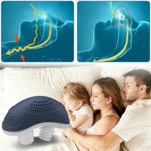 BowLift | Sleepless, maskless, Micro-CPAP Anti-Snoring