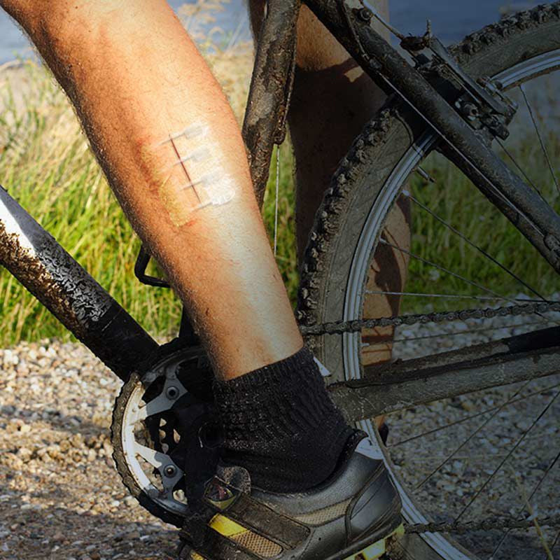 BowLift | Outdoor Zipper Patch