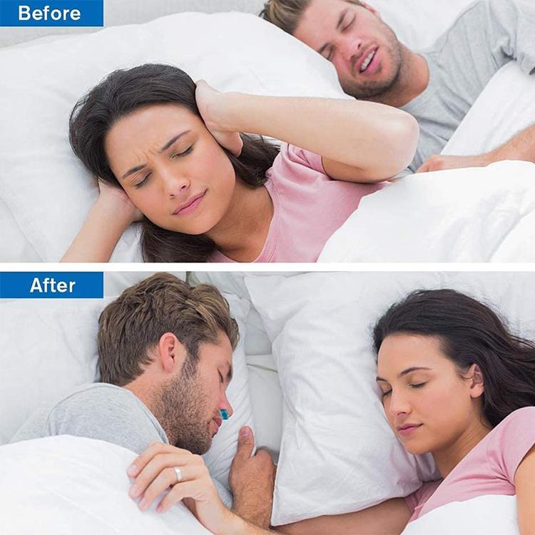 BowLift | Micro CPAP Anti-Snore Electronic Device