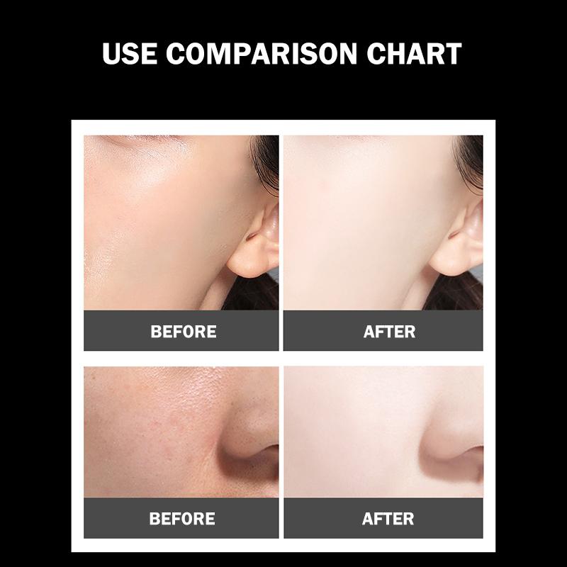 BowLift | Hefe Gold Egg Mask