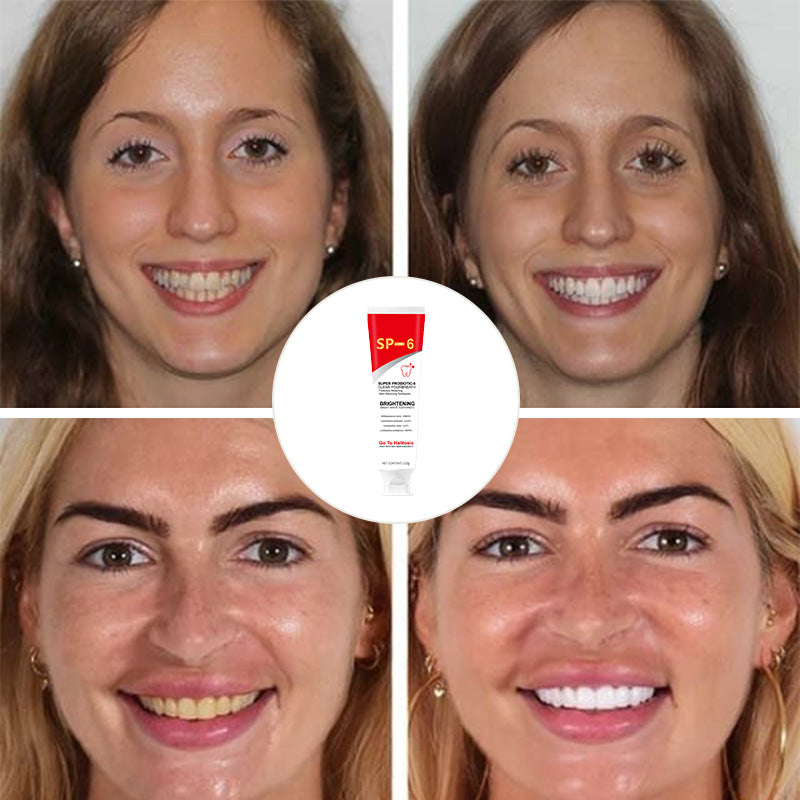 BowLift | Super Probiotic-6 Toothpaste