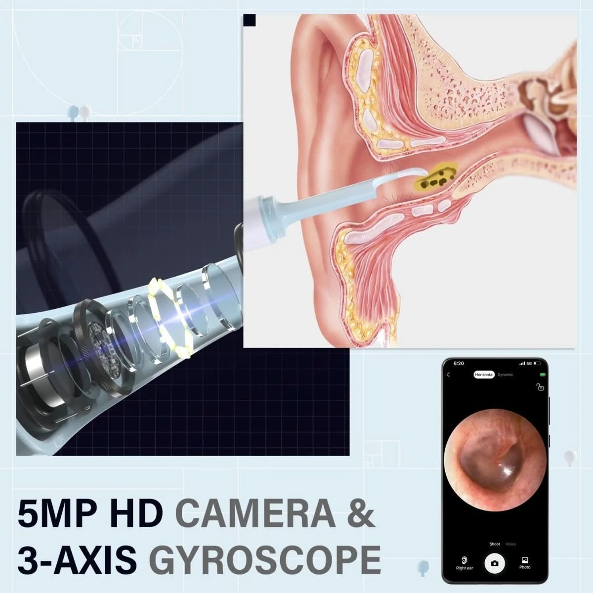 BowLift | Compact tool for clear insights and precise observation