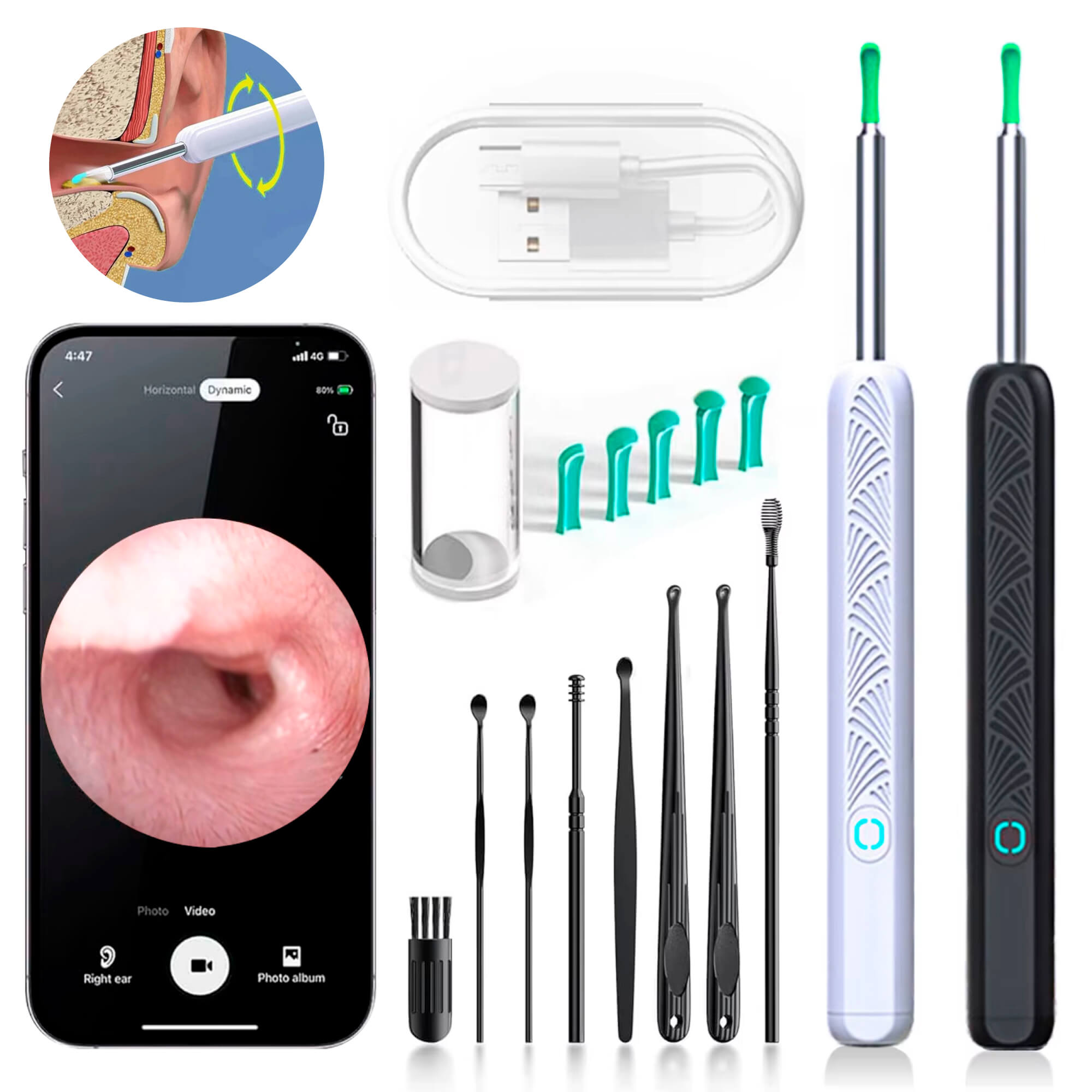 BowLift | EarScope Pro Ear Wax Removal Kit | High-Resolution Camera & LED Lights for Safe Home Use