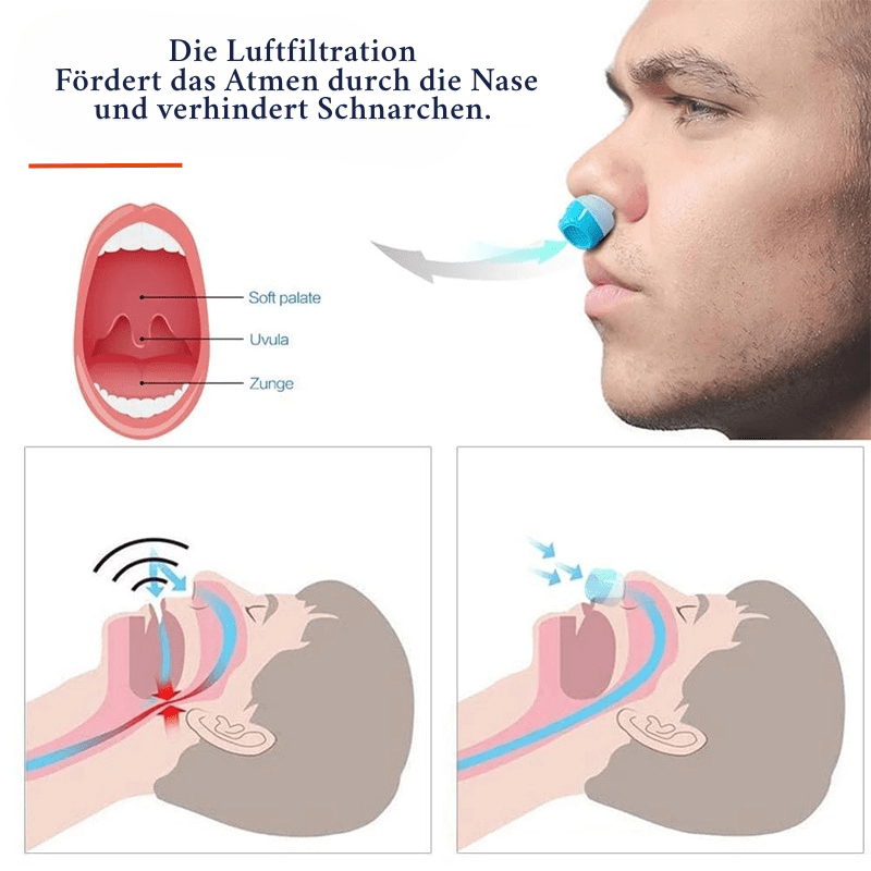 BowLift | Anti-snoring air filter system for better sleep & healthy breathing