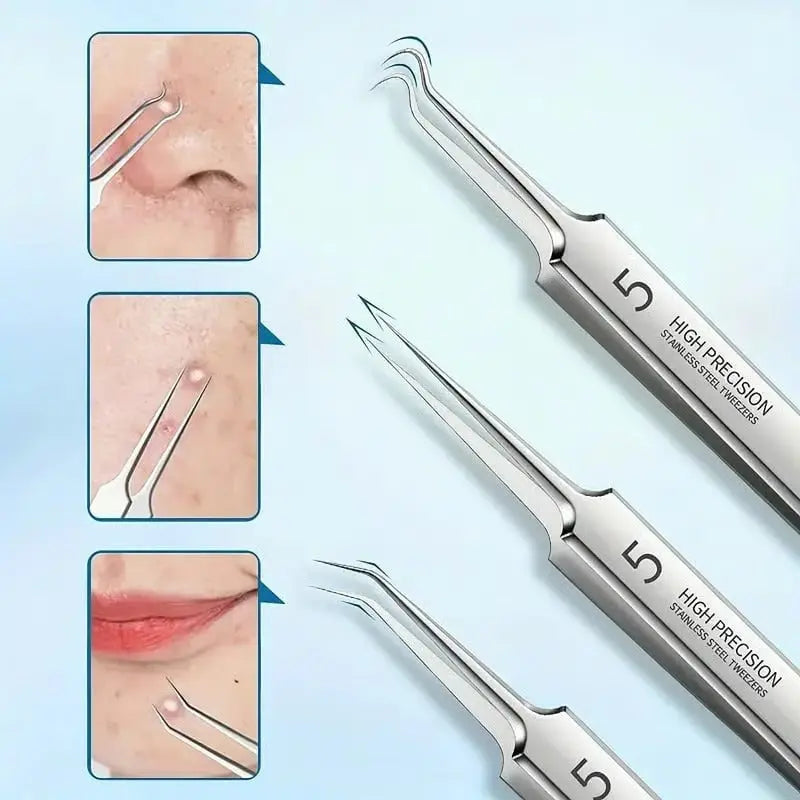 BowLift | Precision Tweezer Set – Acknowledge tools made of stainless steel for flawless skin