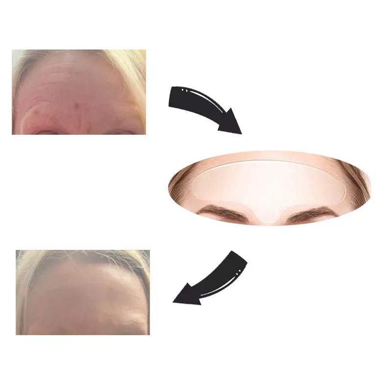 BowLift | Face Lift Reusable Tape