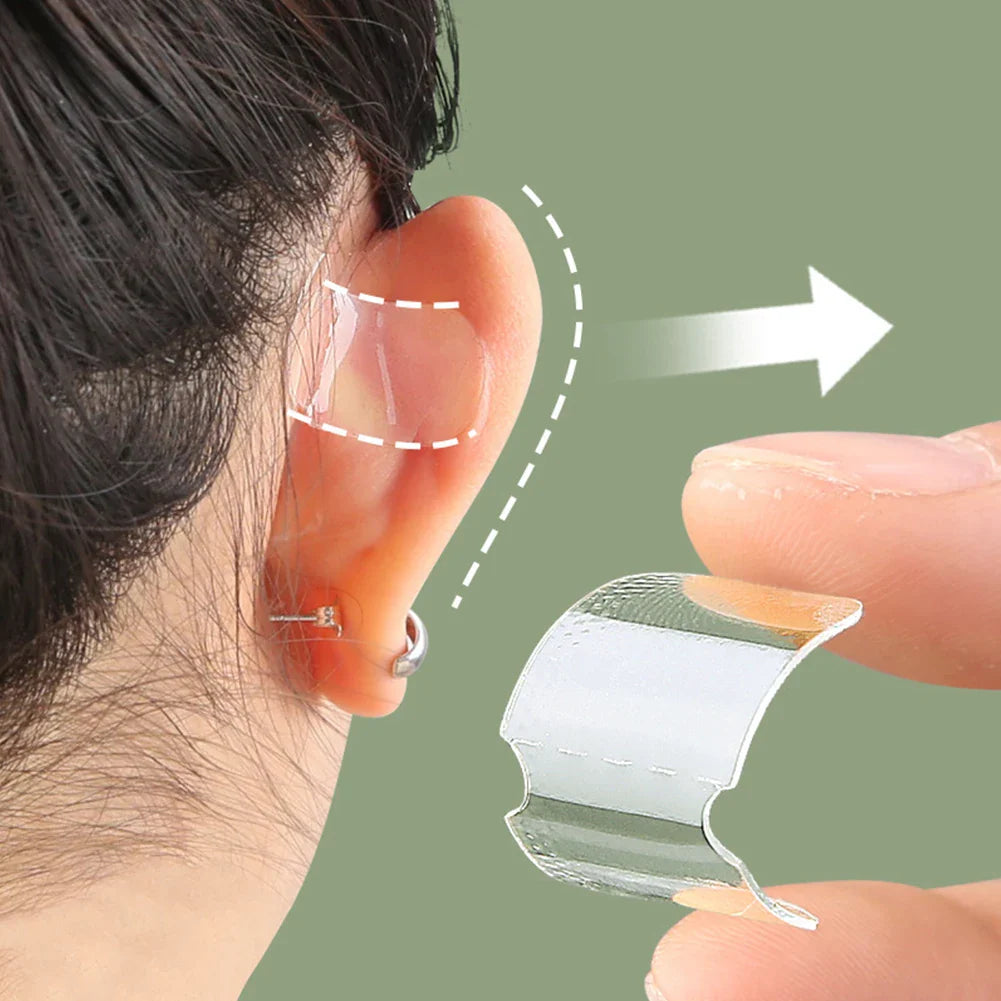 BowLift | Invisible Ear Corrector Stickers