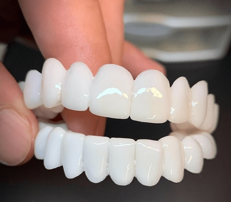 BowLift | Customizable Dental Prosthesis with Dental Lenses