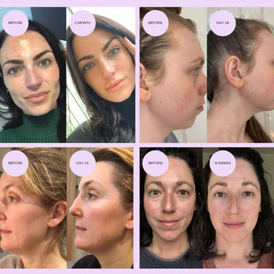 BowLift | 4-in-1 Lumi Lift - improve your skin in 2 days with LED and EMS light therapy