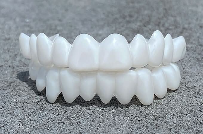 BowLift | Dental prosthesis with white dental lenses
