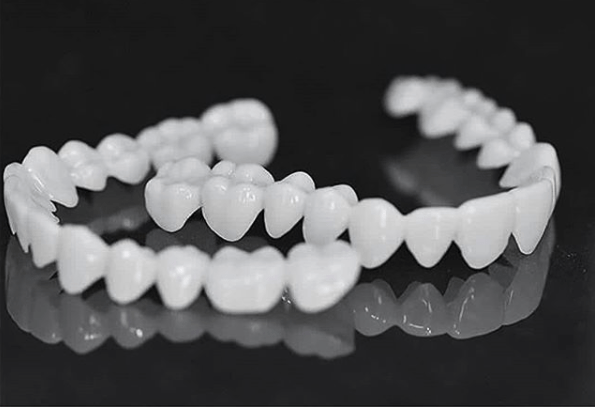 BowLift | Dental prosthesis with white dental lenses
