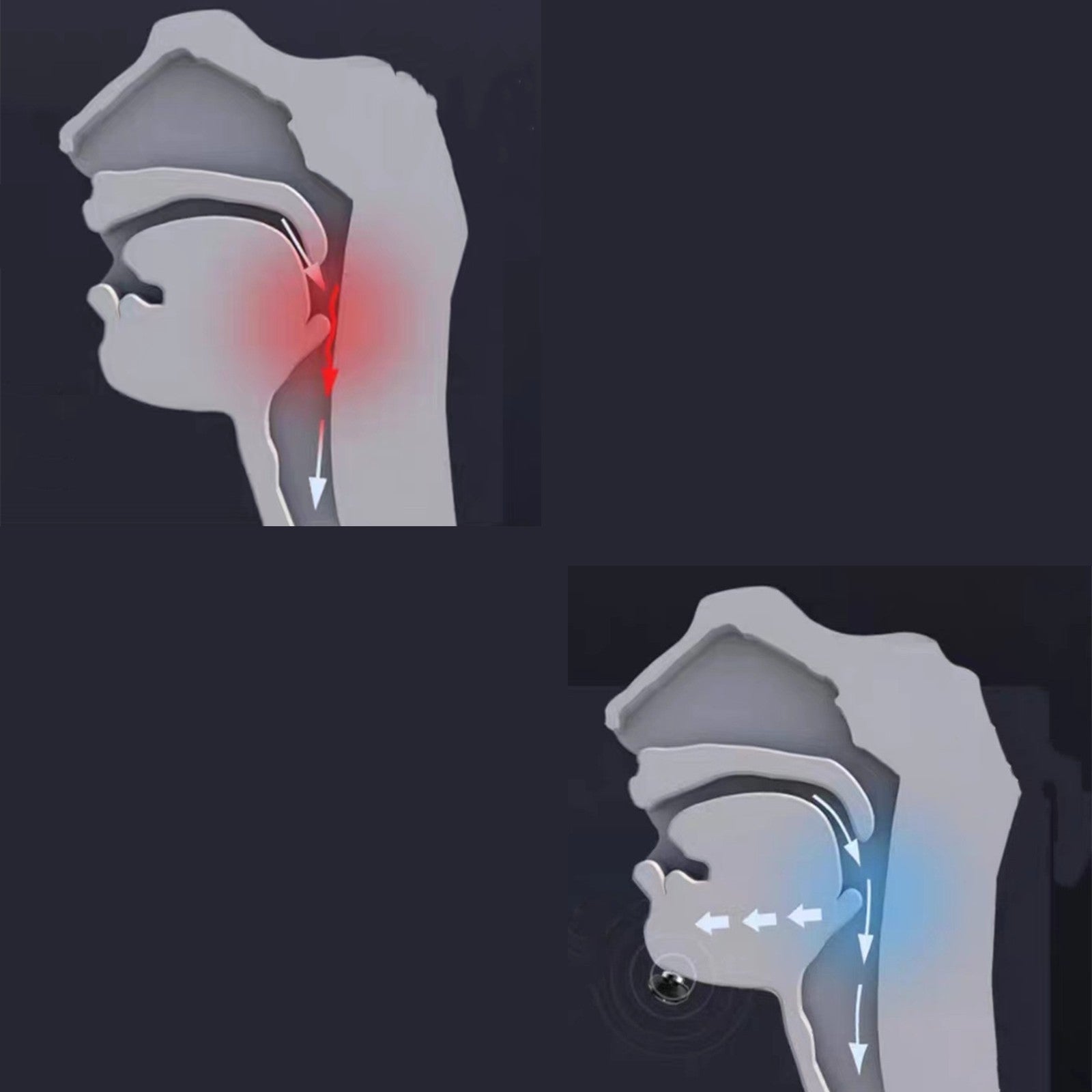BowLift | Premium Anti-Snoring Device, for Men and Women