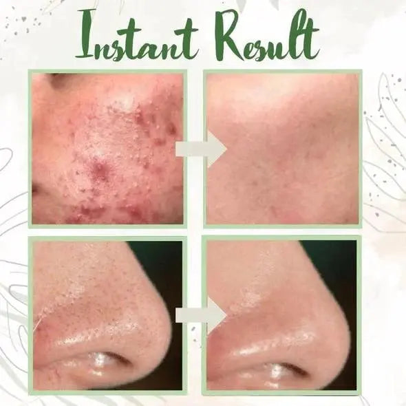 BowLift | Green Tea Deep Cleansing Mask – Against Sebum, Dirt & Clogged Pores