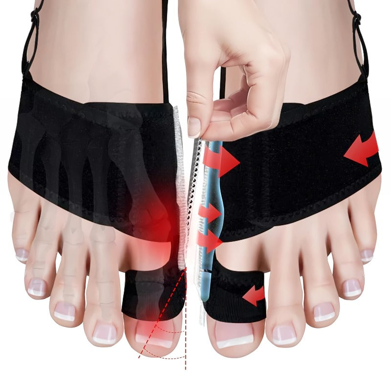 BowLift | Adjustable hallux valgus corrector
