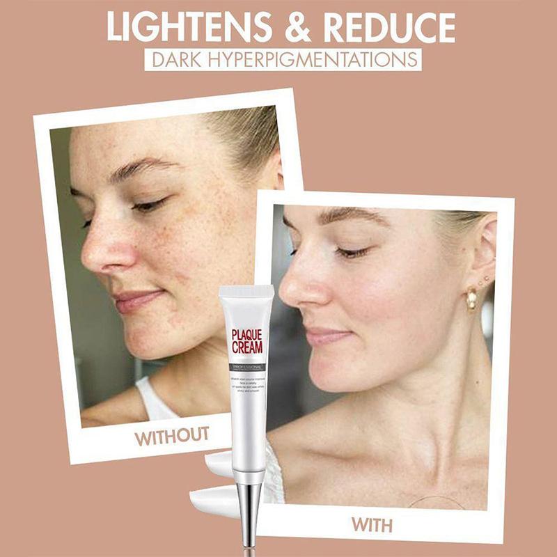 BowLift | Face Freckles Removal Cream