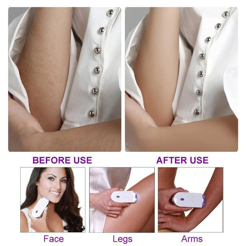 BowLift | Durable and Portable Painless Epilator
