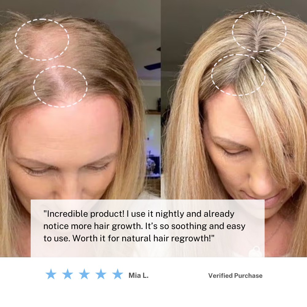 BowLift | Cordless Scalp Massaging Brush – Boost Hair Growth & Relax at Home