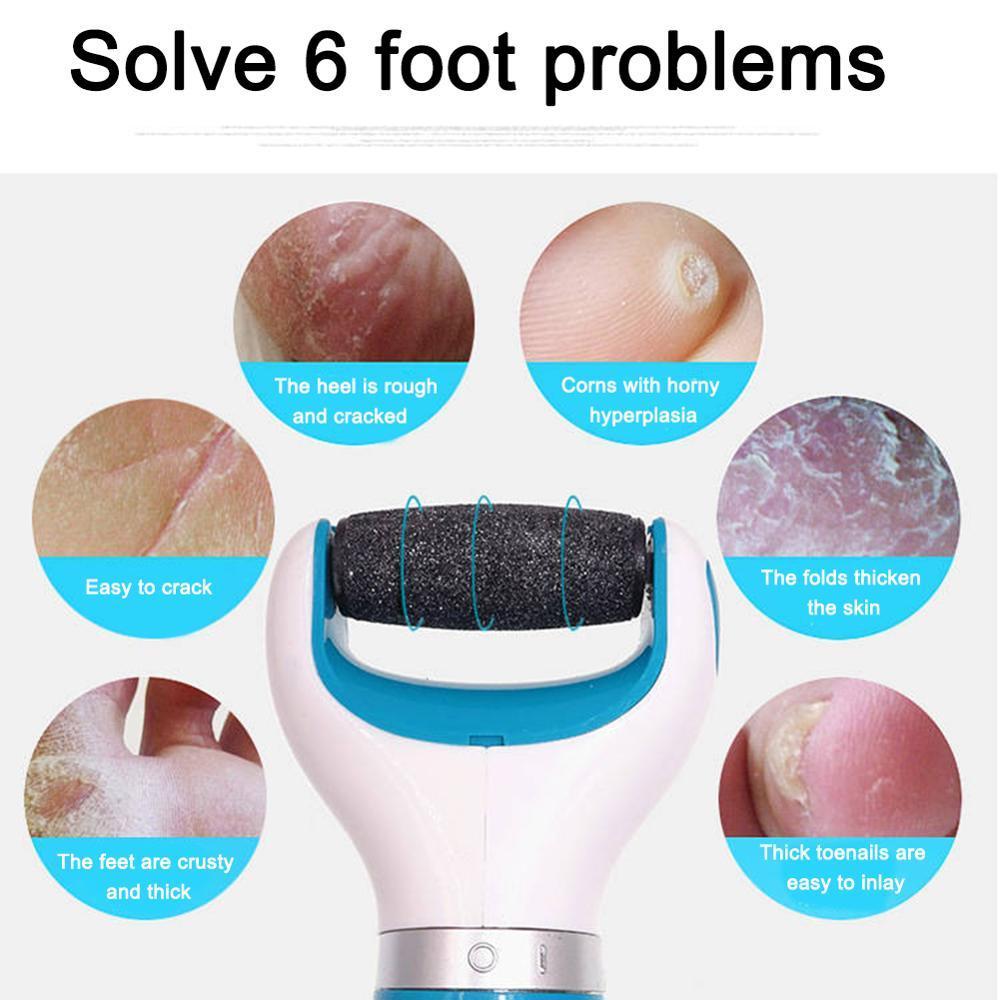 BowLift | Callus Remover Foot Grinder Pedicure
