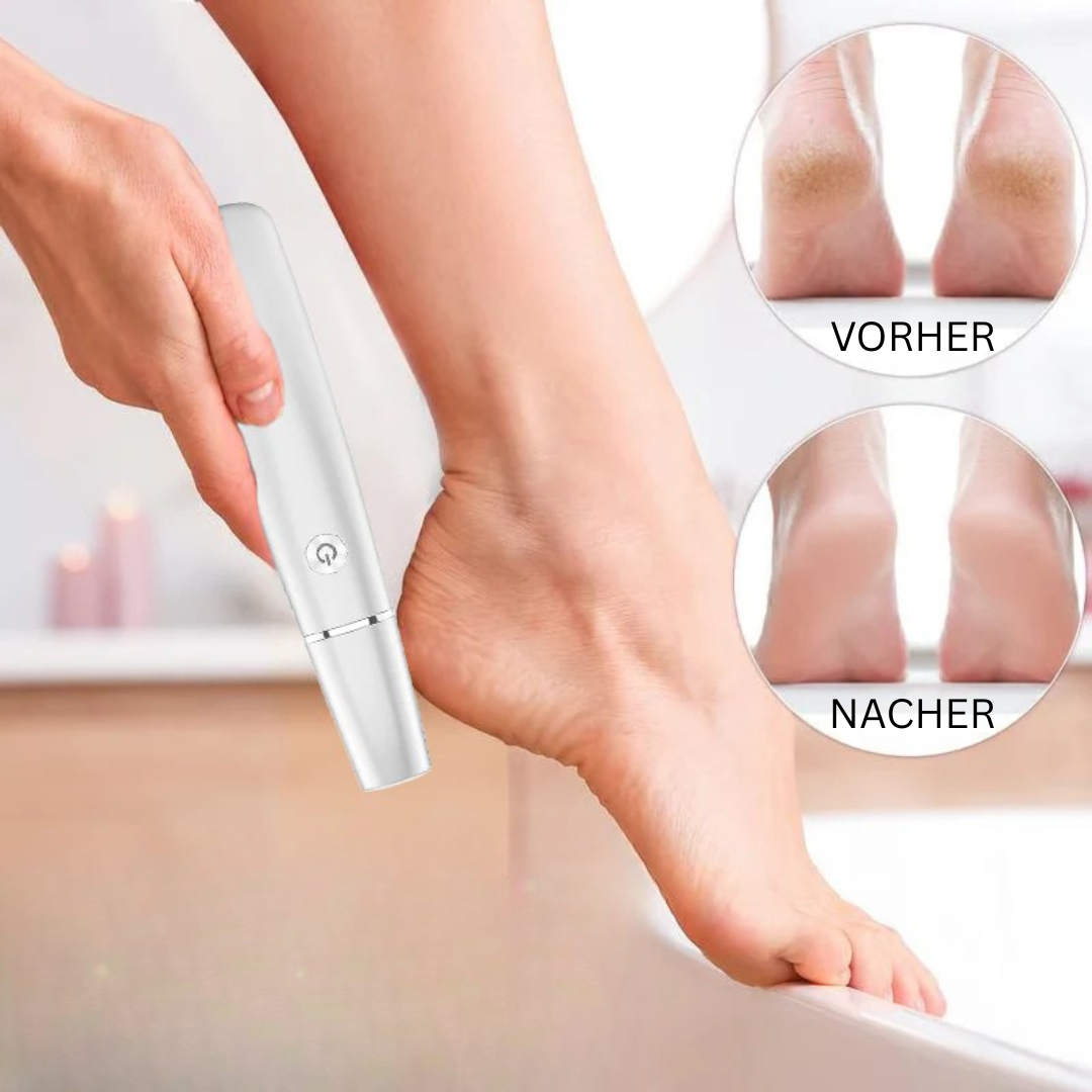 BowLift | Electric Callus Remover for the Feet