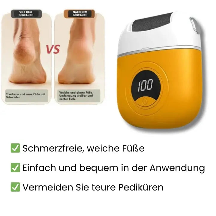 BowLift | Electric callus remover for smooth feet
