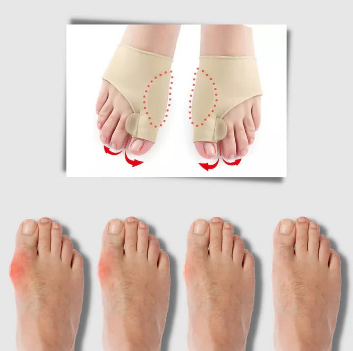 BowLift | Gel bunion corrector