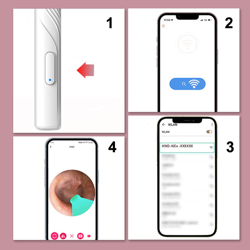 BowLift | Device for earwax removal with HD camera